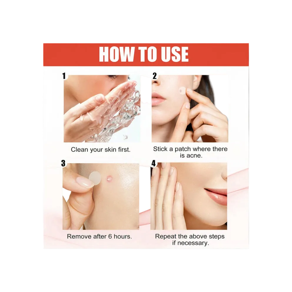 Mağazam acne healing patches in a clear package, featuring individual patches for targeted blemish treatment.